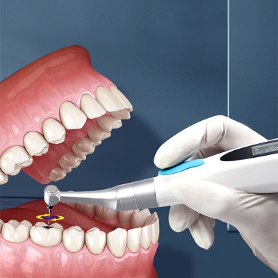 Беспроводной стоматологический эндомотор Sunt smil Dens, 9 программ-5